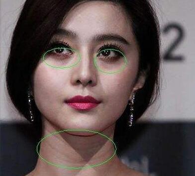 第4张图片