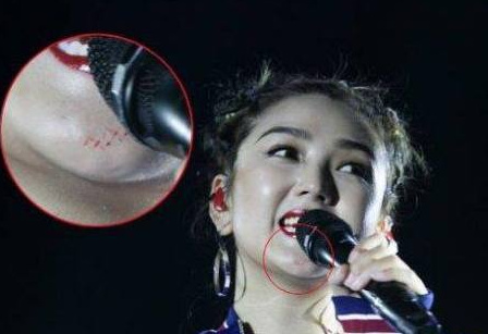 第3张图片